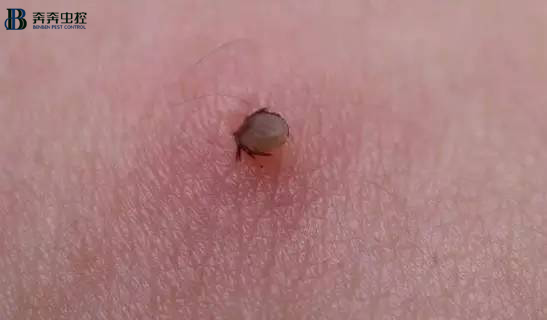 解讀蜱蟲預(yù)防與處理，值得收藏！